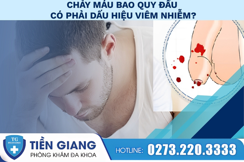 Chảy máu bao quy đầu là dấu hiệu của nhiều bệnh lý nguy hiểm.