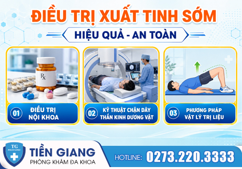 Các phương pháp hỗ trợ điều trị xuất tinh sớm hiệu quả.