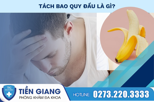 Khi nào nam giới cần thực hiện tách bao quy đầu?