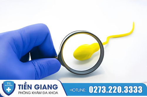 Nam giới cần thận trọng khi tinh trùng có màu vàng