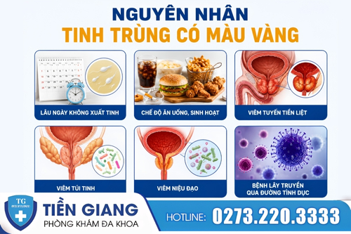 Nguyên nhân khiến tinh trùng có màu vàng.