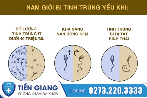 Khi nào được xem là tinh trùng yếu?