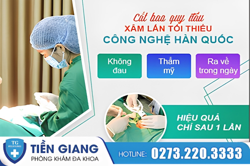 Tách bao quy đầu bằng kỹ thuật xâm lấn tối thiểu Hàn Quốc.