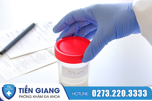 Xét nghiệm tinh dịch là phương pháp giúp kiểm tra chất lượng tinh trùng.